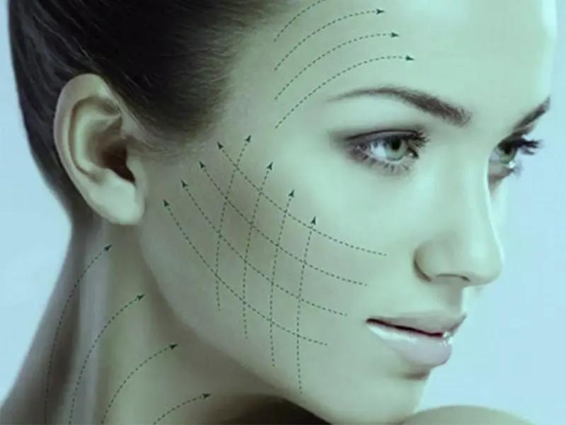 لیزر اندولیفت چیست؟