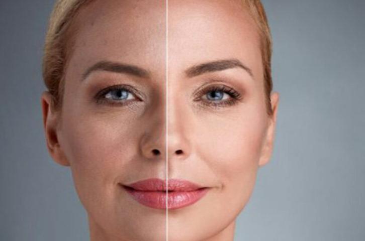 شرایط پذیرش اندولیفت در درسا کلینیک