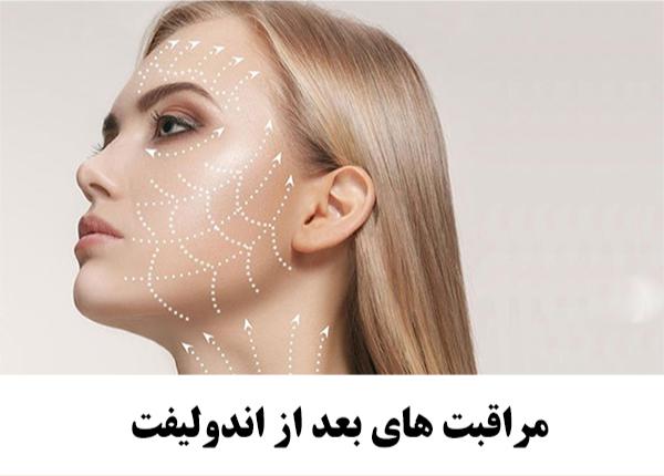 اهمیت مراقبت ها پس از اندولیفت