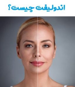 روزه داری چه تاثیراتی روی پوست می گذارد؟