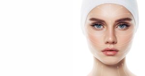 ماندگاری و دوام لیفت با نخ چقدر است؟