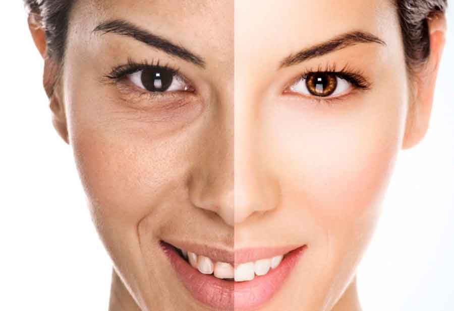 کربوکسی تراپی چیست؟