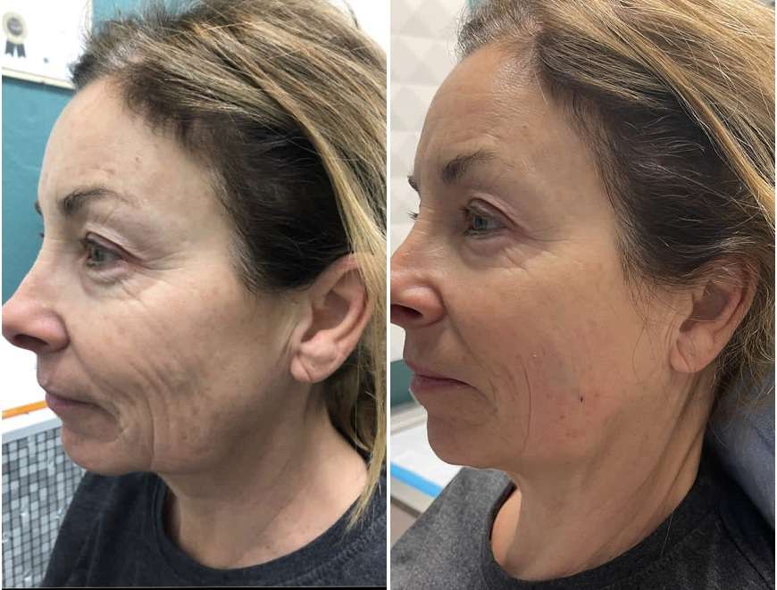 فواید روزه داری برای پوست