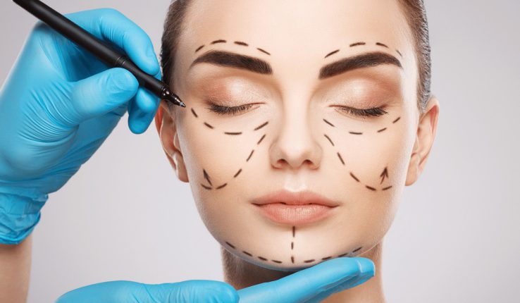 اقدامات بعد از لیفت نخ