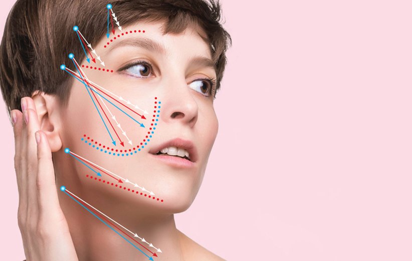 انواع نخ لیفت صورت