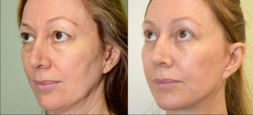 عدم مصرف نوشیدنی های الکلی و دخانیات