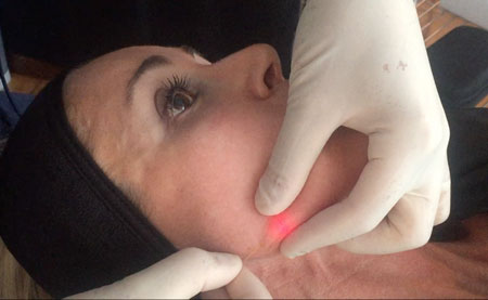 مدت زمان جلسات اندولیفت چقدر است؟