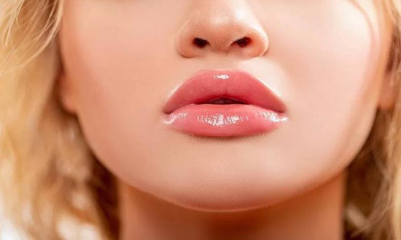        ژل ژوویدرم (Juvederm)