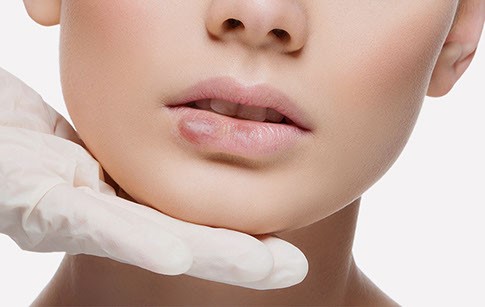    ممنوعیت مشغولیت با فعالیت های سنگین