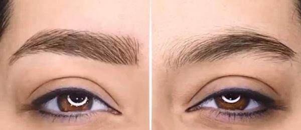 فرق فیبروز ابرو با میکرونیدلینگ چیست؟