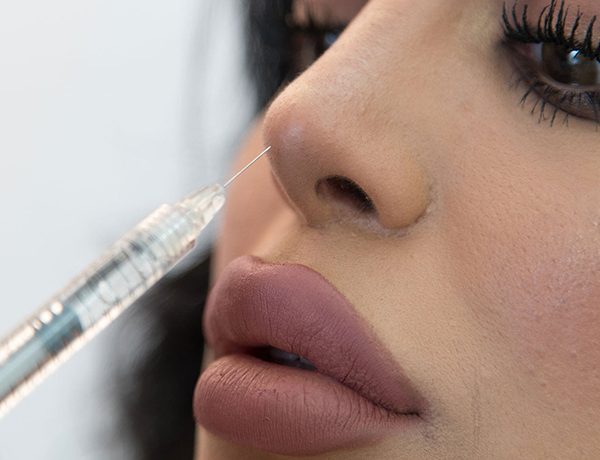 تزریق فیلر برای فرم‌دهی بینی چطور انجام می‌شود؟