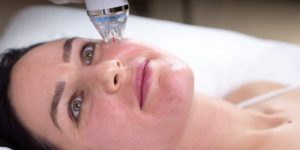 عوارض میکرونیدلینگ صورت