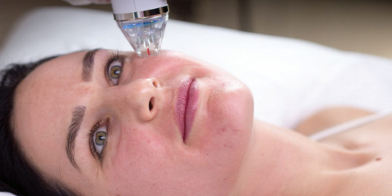 عوارض میکرونیدلینگ صورت