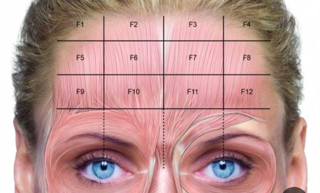 نحوه تزریق بوتاکس