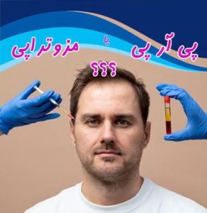 مزوتراپی بهتر است یا پی آر پی
