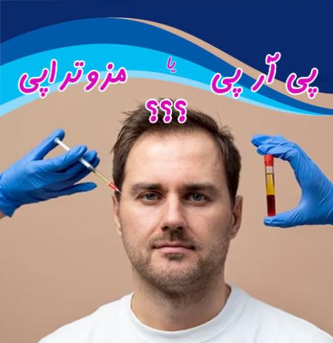 مزوتراپی بهتر است یا پی آر پی