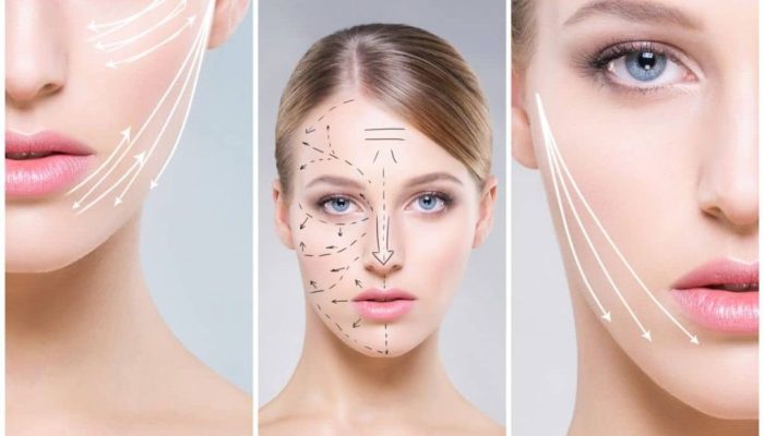 لیفت نخ راهی کم عارضه برای جوانی و جلوگیری از چین و چروک