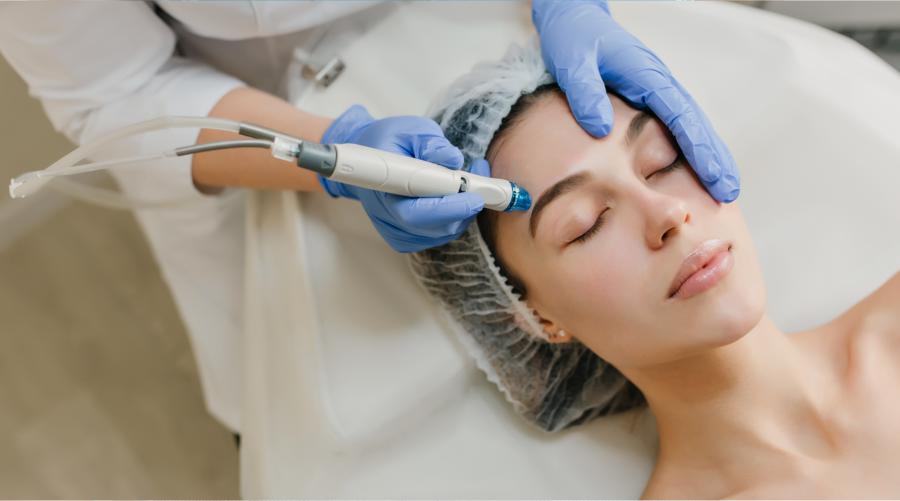 آر اف فرکشنال چیست؟