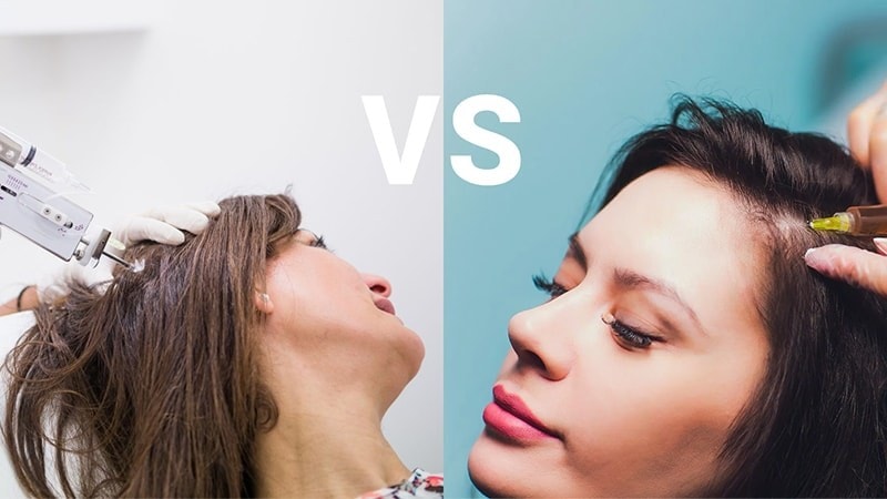 انتخاب بین مزوتراپی یا پی آر پی به چه عواملی بستگی دارد؟