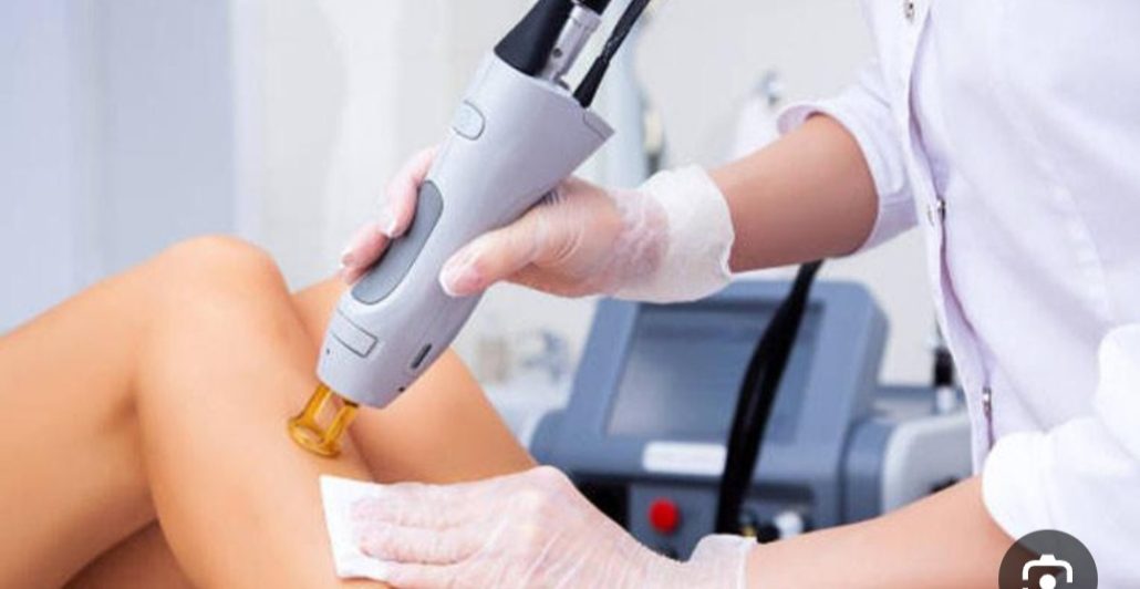 باید و نبایدهای لیزر موهای زائد