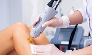 باید و نبایدهای لیزر موهای زائد