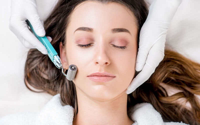 عوارض انجام میکرونیدلینگ صورت