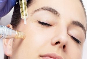 مزوتراپی چگونه پوست را تازه و جوان نگه می دارد؟