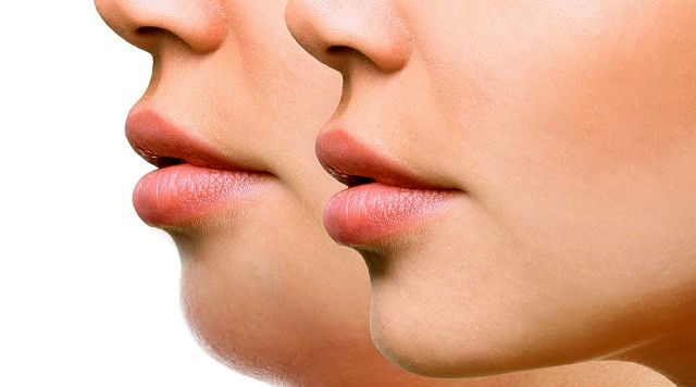 سریعترین راه رفع غبغب