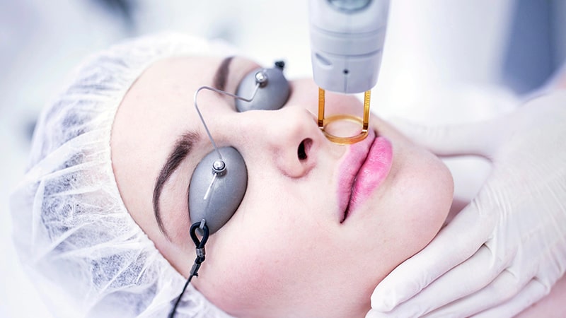 نحوه روشن سازی پوست در اثر لیزر موهای زائد