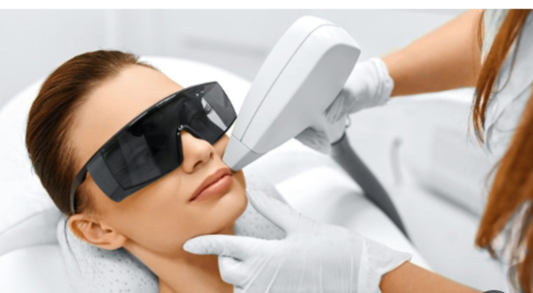 افراد منع از انجام لیزر موهای زائد