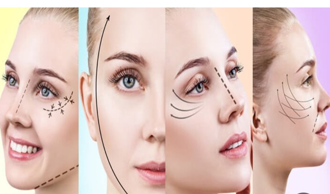 هزینه زاویه سازی صورت با نخ