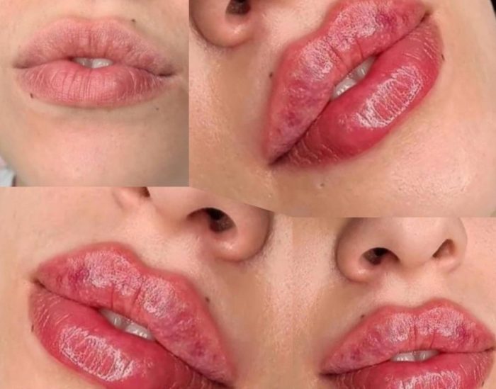     ژل لب تئوسیال