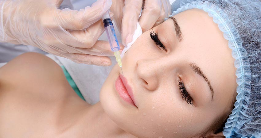 انواع فیلرها