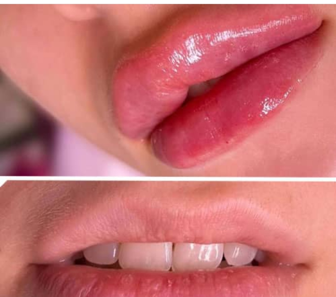 ویژگی های بهترین برند ژل لب