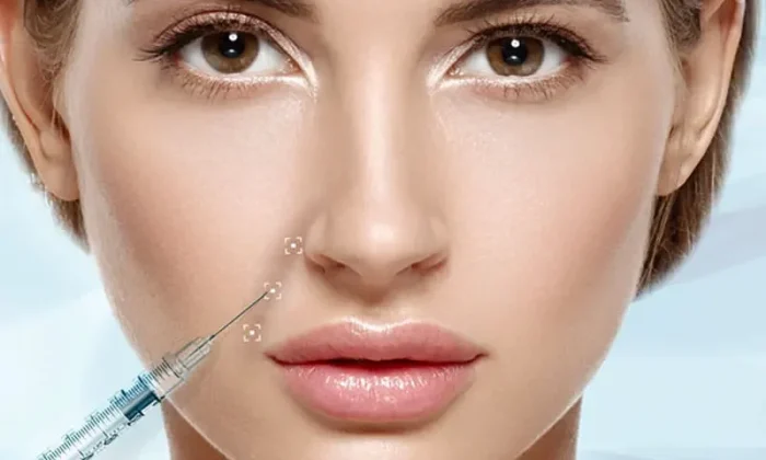 تزریق خط خنده چیست؟