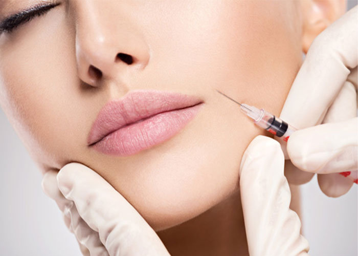 تزریق بوتاکس خط خنده