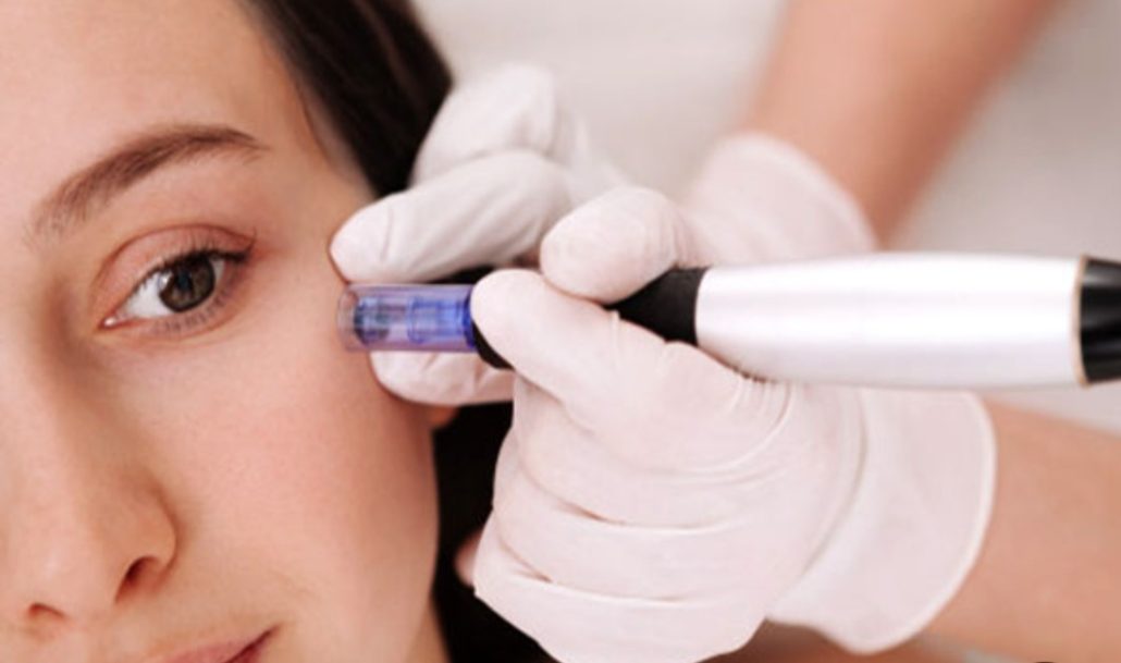 مزوتراپی صورت چیست؟