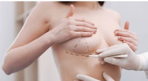 مزایا و معایب لیفت سینه