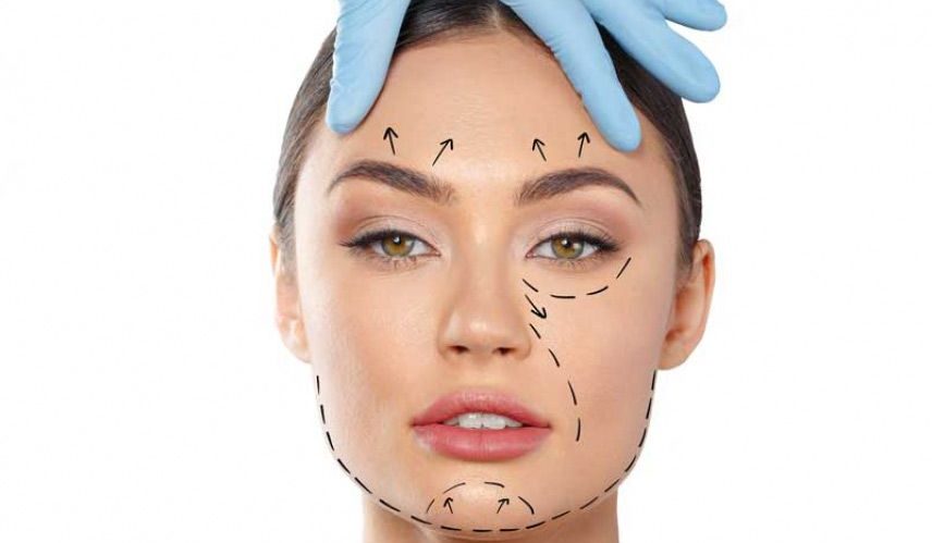 مزایای استفاده از نخ آپتوس