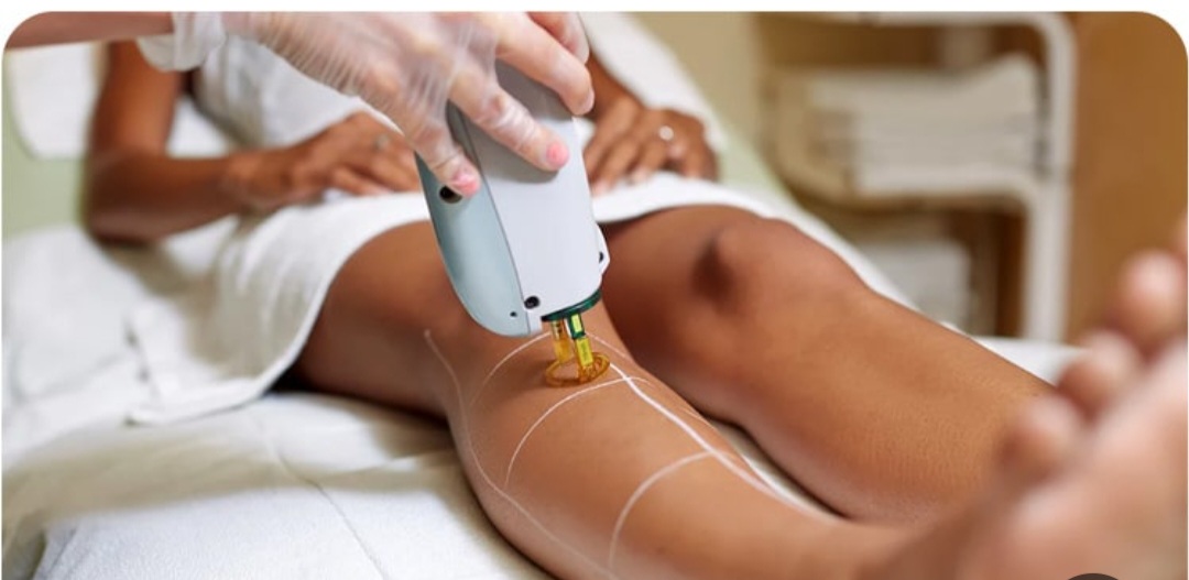 آیا لیزر موهای زائد در خانم‌ها و آقایان یک نتیجه مشابه به دنبال دارد؟