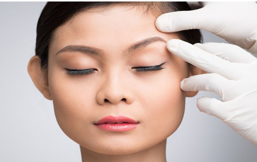 نحوه انجام لیفت نخ چشم