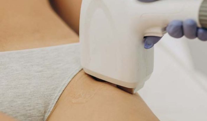 چرا موهای ناحیه بیکینی را لیزر می‌کنیم؟