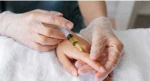 تزریق ژل دست