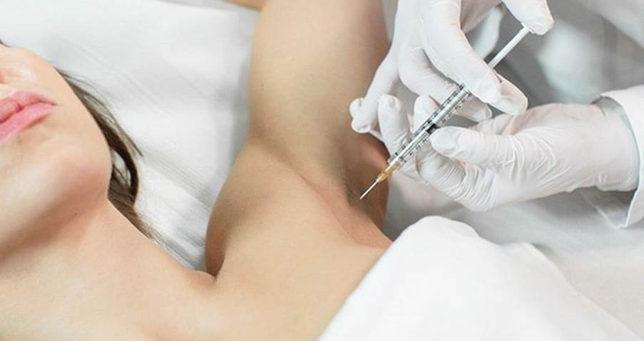 بوتاکس زیربغل برای انجام به چه کسانی پیشنهاد می شود؟