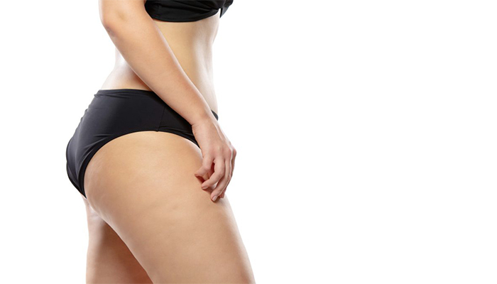 انواع تزریق چربی به گونه ها