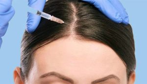 مراقبت های بعد از مزوتراپی