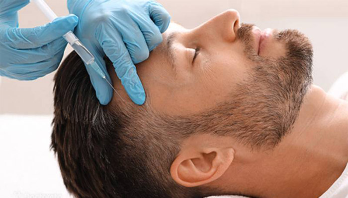 عوارض مزوتراپی مو