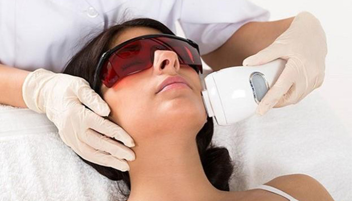 نحوه جلوگیری از رشد دوباره مو بعد از لیزر