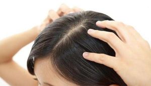 راه های پیشگیری ریزش مو
