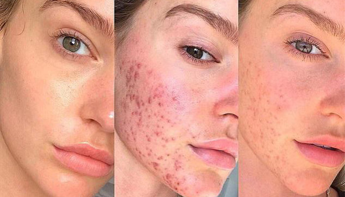 برای ترمیم پوست چی خوبه؟